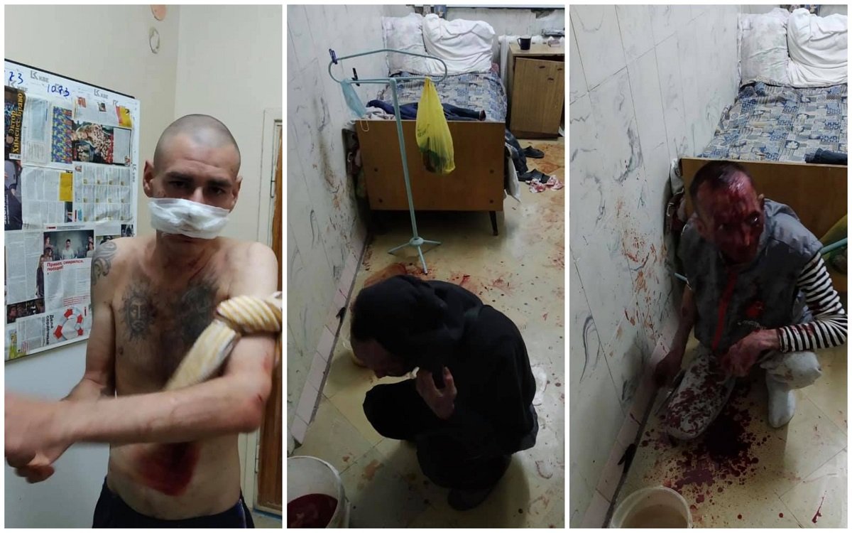 После побоища вся комната была в пятнах крови