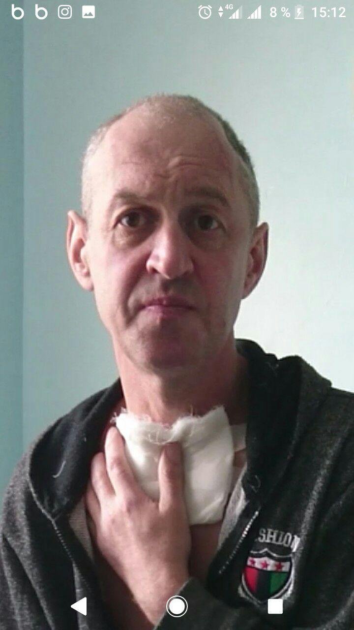 В Днепре пропал 49-летний мужчина с травмой головы В Днепре пропал 49-летний мужчина с травмой головы