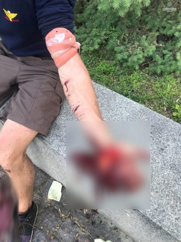 Патрульные оказали помощь и остановили кровотечение 