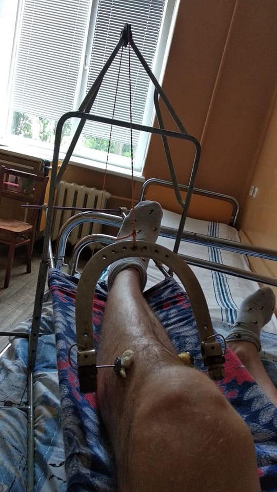 Пострадал водитель