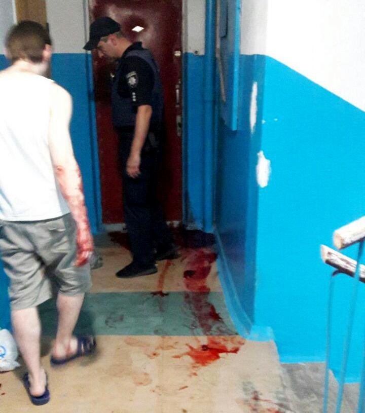 В Днепре в подъезде женщину ударили топором по голове В Днепре в подъезде женщину ударили топором по голове