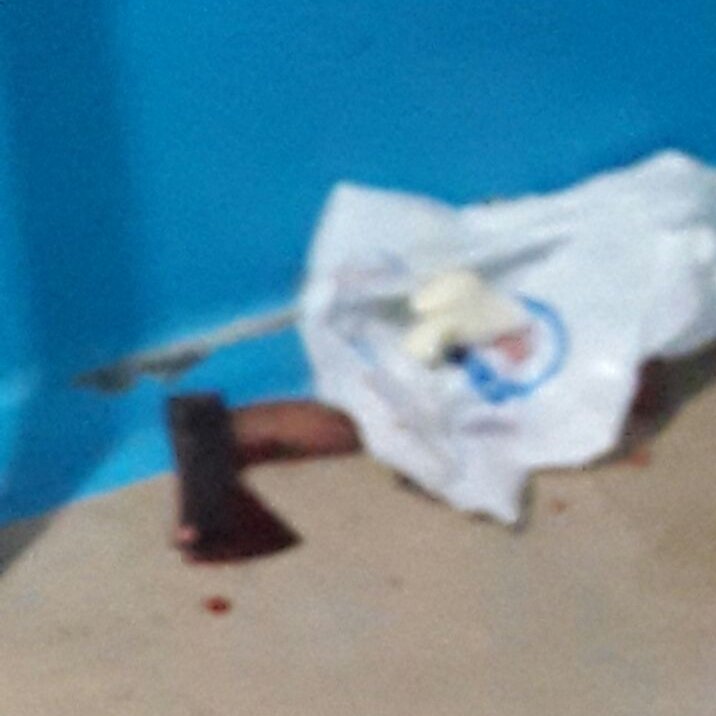 В больнице Днепра умерла женщина, которую ударили топором по голове 1