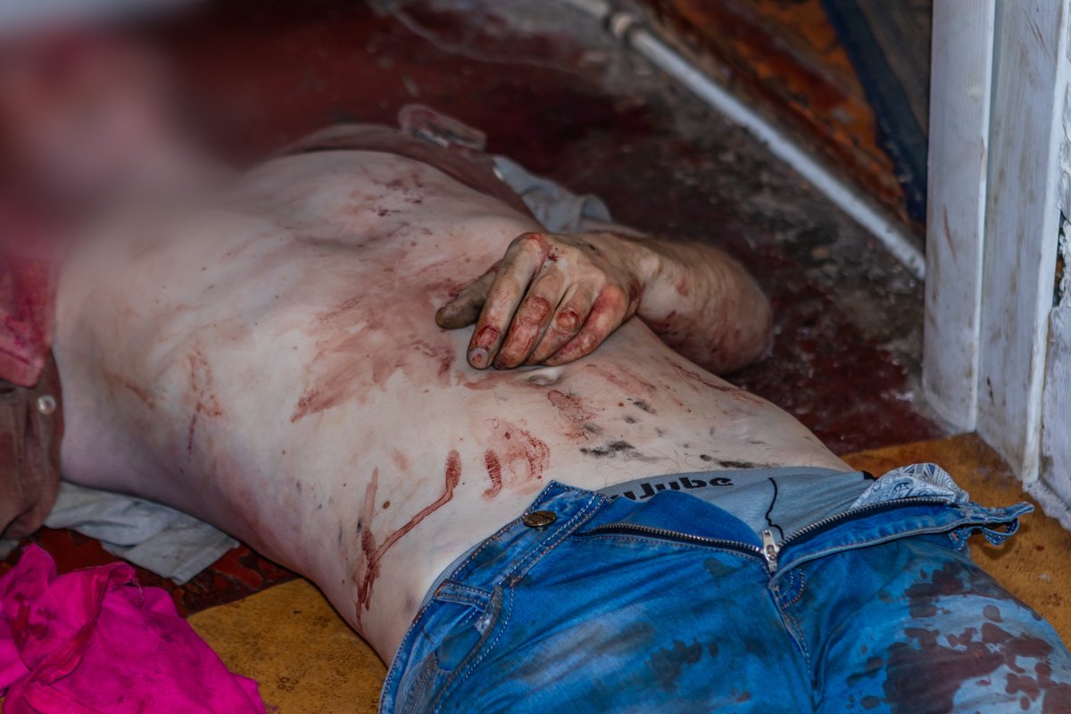 Погибшему было примерно 35 лет, все его тело, руки и лицо было в крови