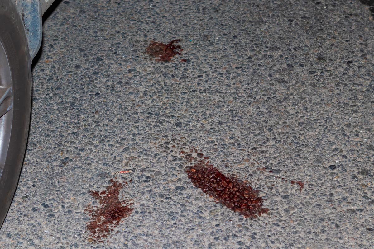 Мужчина различные травмы и, предположительно, перелом ребер Мужчина различные травмы и, предположительно, перелом ребер