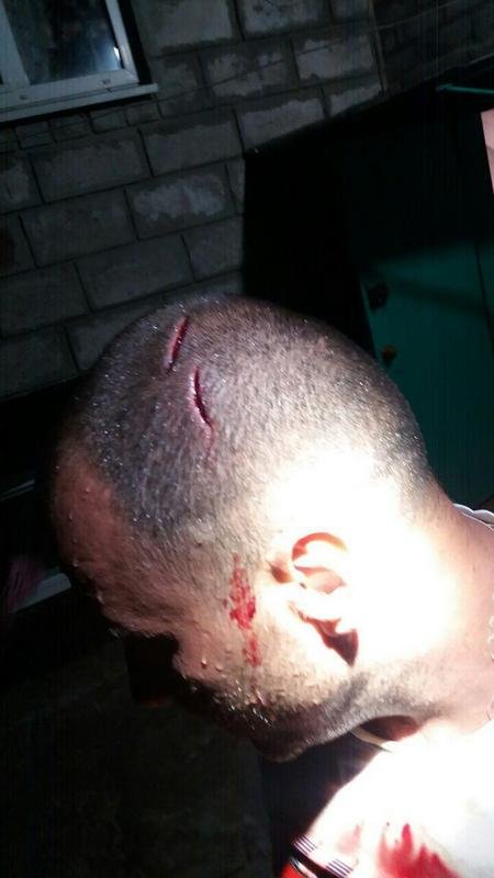 Могло закончиться куда хуже Могло закончиться куда хуже