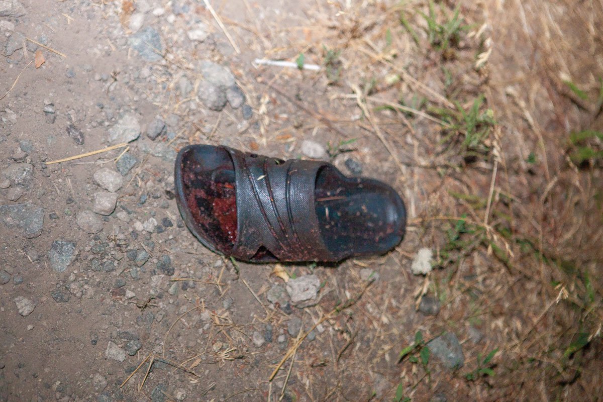 Ребята возрастом от 5 до 16 лет, травмы различной степени тяжести, у некоторых оторваны пальцы Ребята возрастом от 5 до 16 лет, травмы различной степени тяжести, у некоторых оторваны пальцы