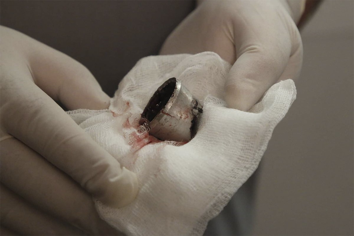 Предмет, который попал в ребенка