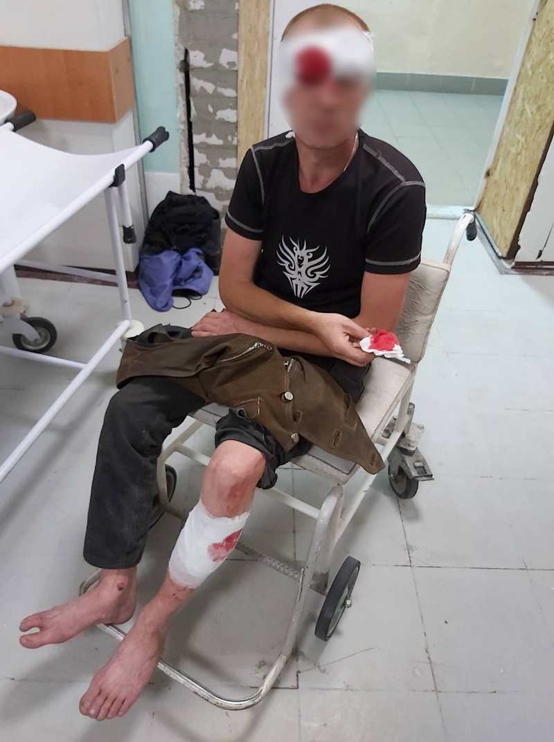 Сейчас пострадавший находится под присмотром медиков 16-й городской больницы