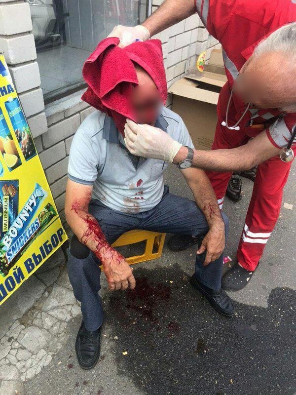 В голову из травматического пистолета В голову из травматического пистолета