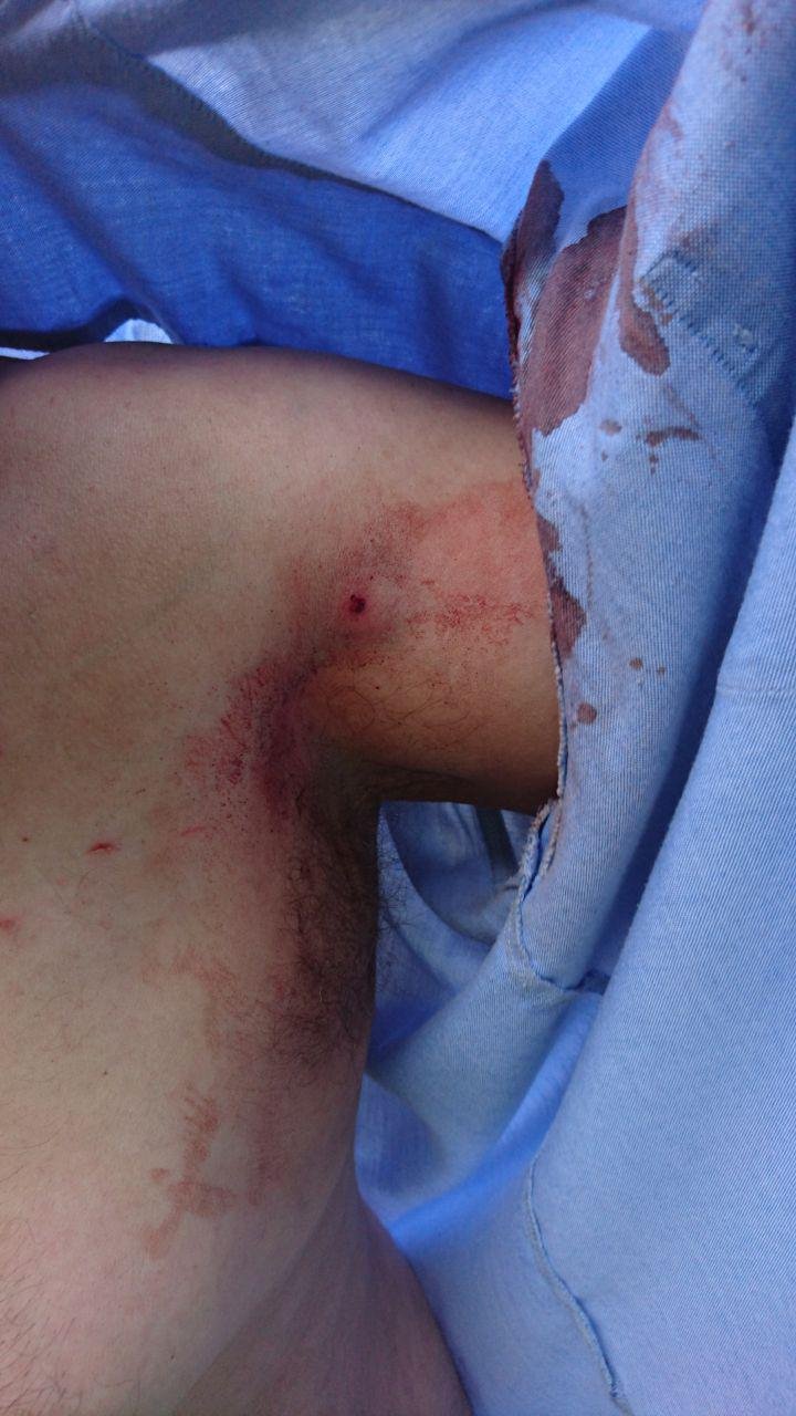 Выстрелил в руку Выстрелил в руку