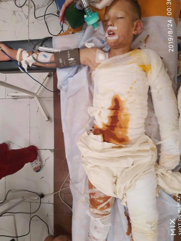 Малыш в реанимации