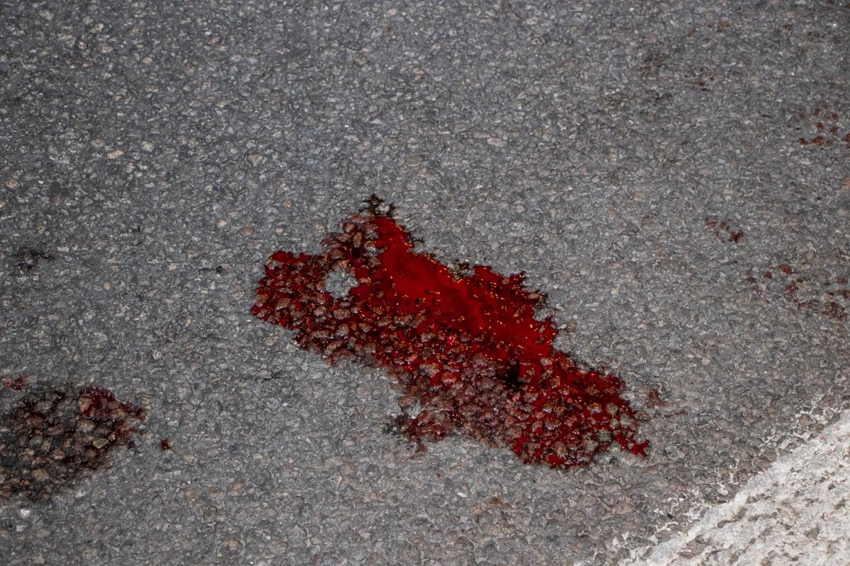 Кровь пострадавшего в ДТП Кровь пострадавшего в ДТП