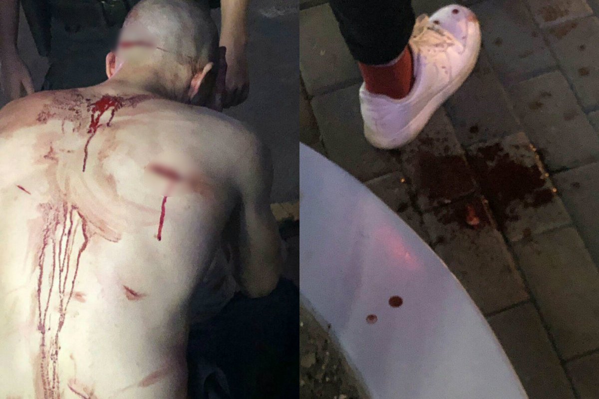 Между двумя мужчинами завязалась драка, в ходе которой один ударил другого ножом