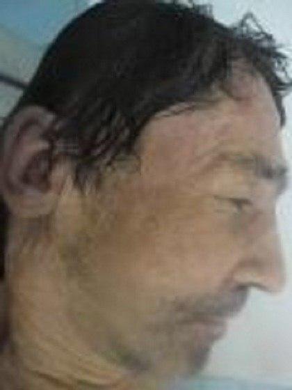 Вероятно, мужчина погиб из-за отравления алкоголем 