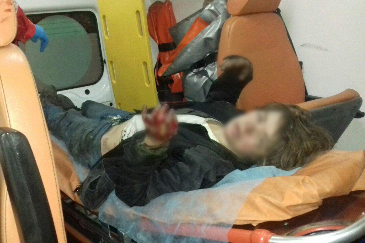 Спасатели достали из горящего подвала 34-летнюю женщину