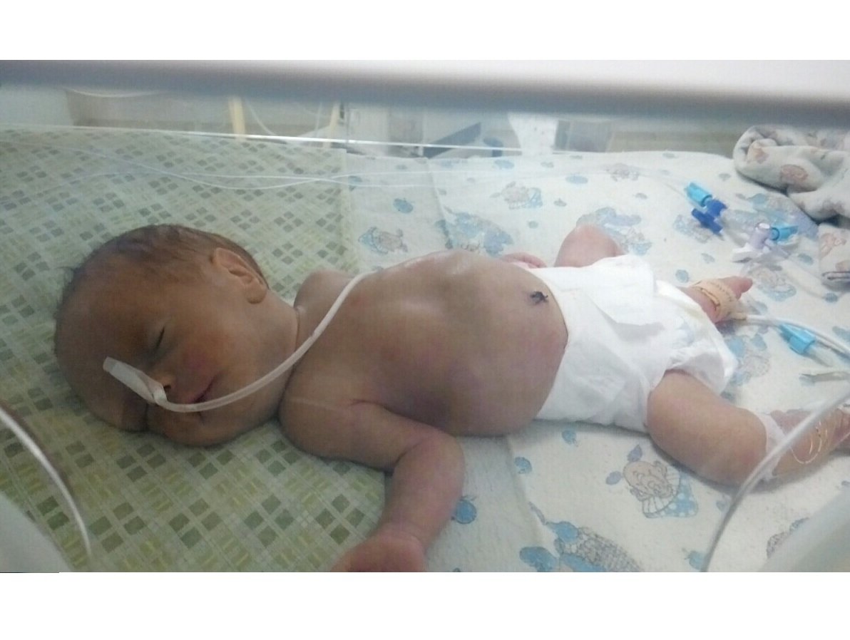 Ежедневно Косте требуются дорогостоящие антибиотики Ежедневно Косте требуются дорогостоящие антибиотики