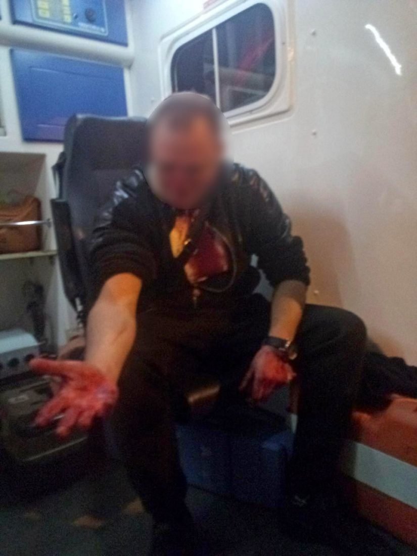 Мужчину ударили ножом в шею и разбили нос