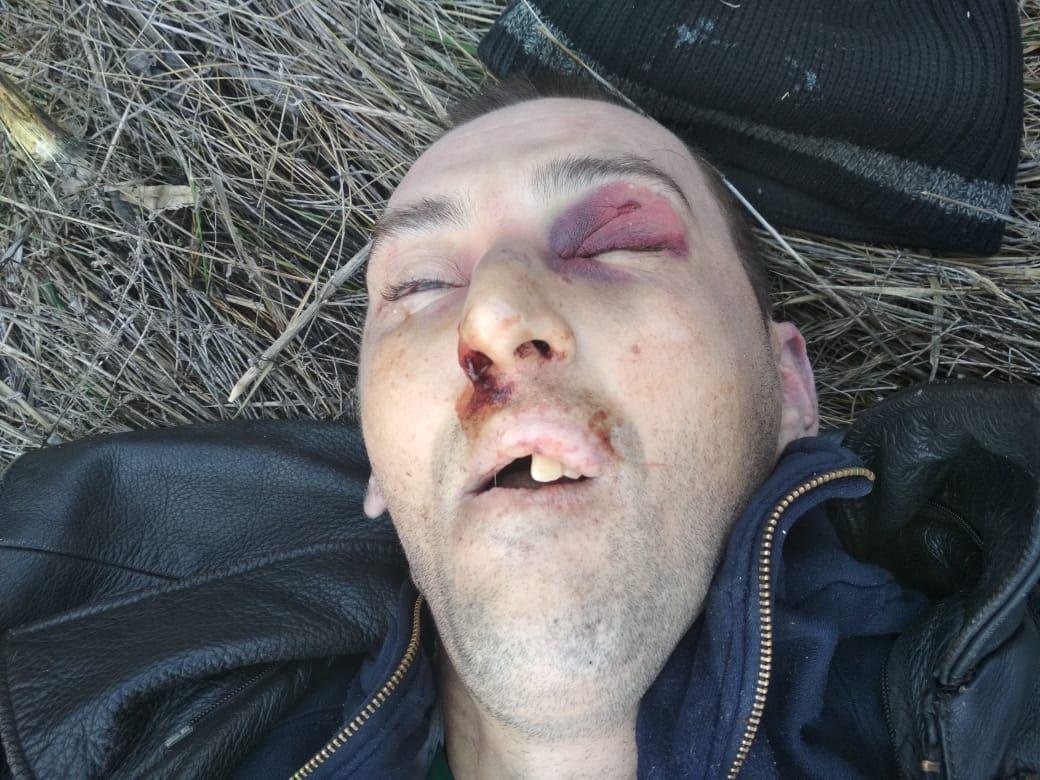 Умерший мужчина был сильно избит Умерший мужчина был сильно избит