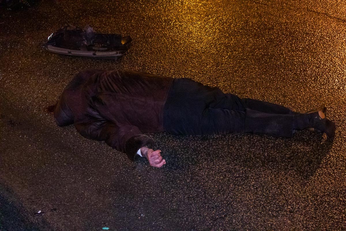 Мужчина получил сильные травмы