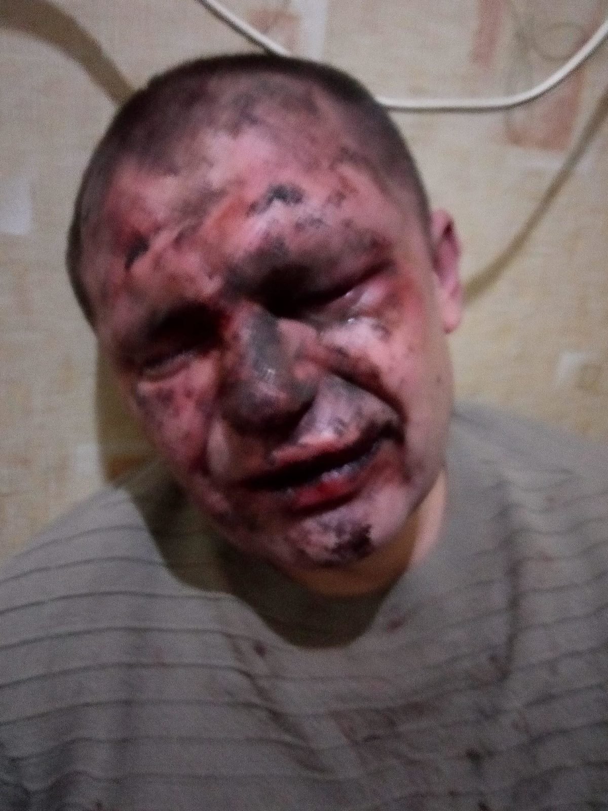 Били ногами по голове Били ногами по голове