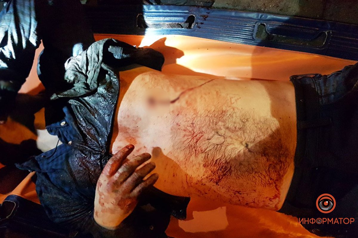 Несмотря на быстрое реагирование и оперативность медиков, спасти мужчину не удалось