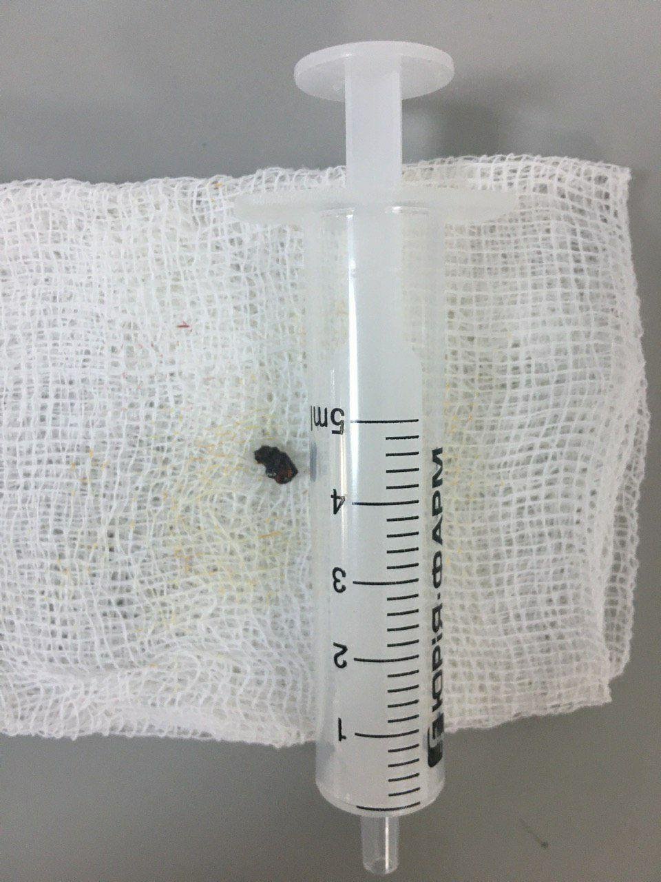 В больницу Днепра эвакуировали бойца с осколочным ранением 1