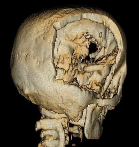 Операция прошла успешно Операция прошла успешно