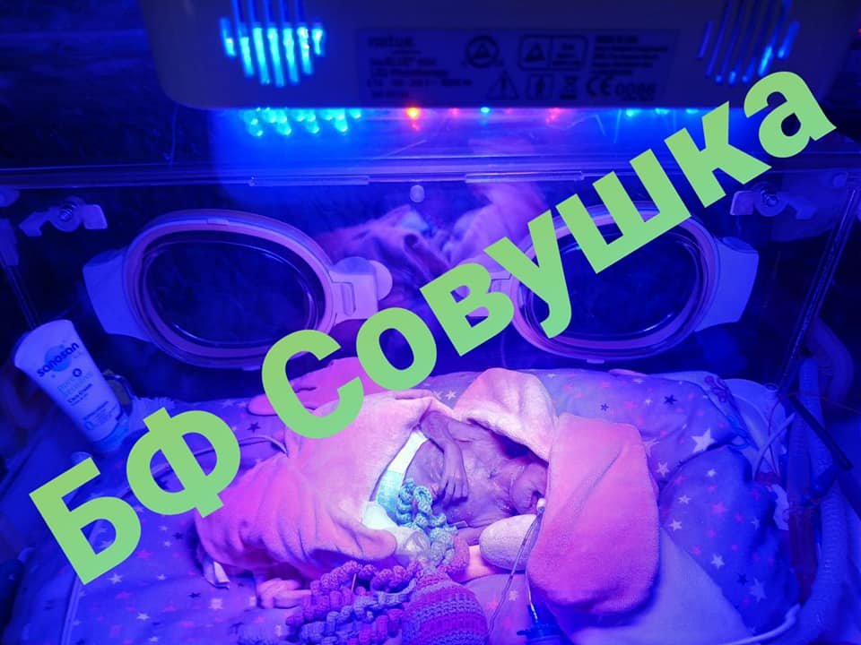 В Днепре преждевременно родилась крохотная девочка: ребенок борется за жизнь 1