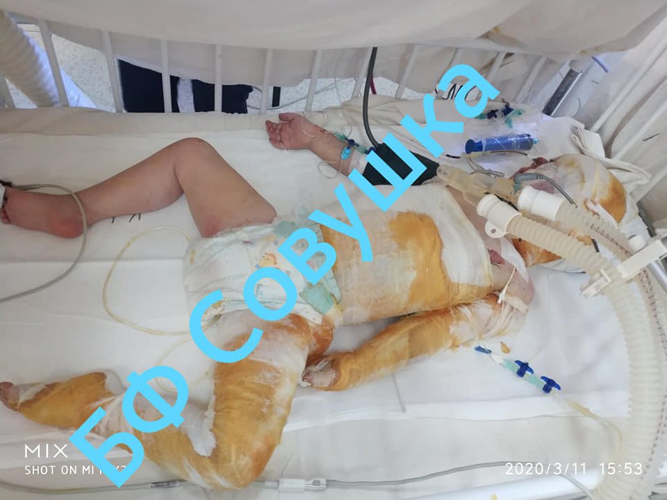 За жизнь обоих детей сейчас борются врачи За жизнь обоих детей сейчас борются врачи
