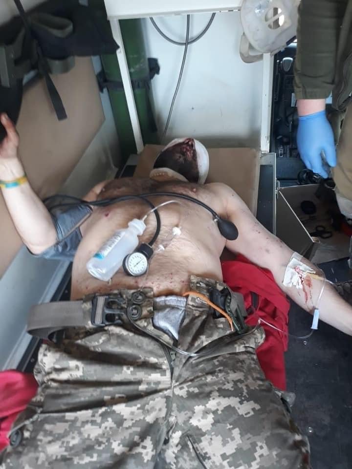 В Днепр доставили Защитников, пострадавших от обстрела гранатометом: нужна помощь 1