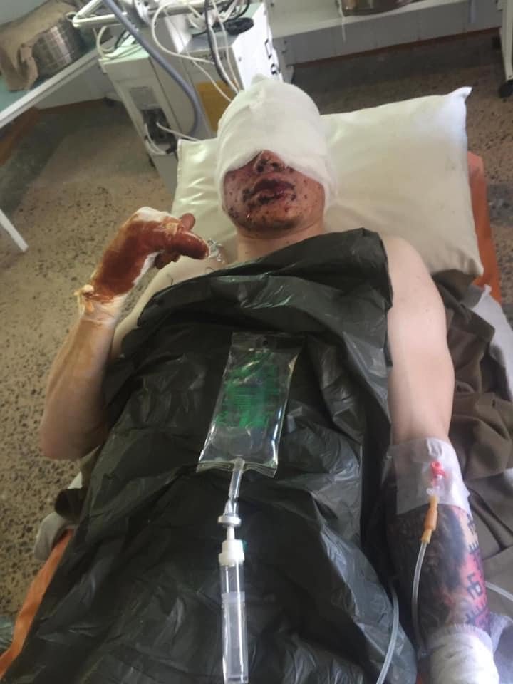 В Днепр доставили Защитников, пострадавших от обстрела гранатометом: нужна помощь 2