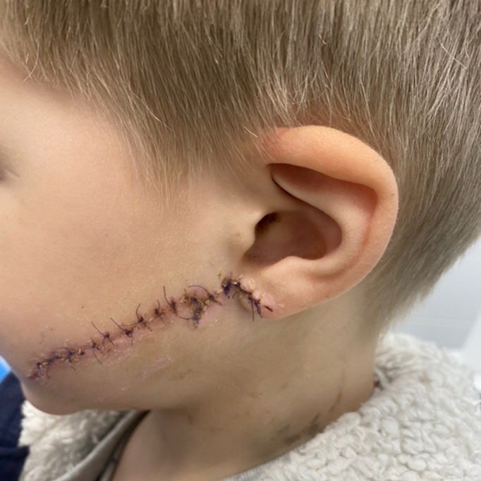 8 апреля 5-летнего мальчика покусала беспородная домашняя собака 8 апреля 5-летнего мальчика покусала беспородная домашняя собака