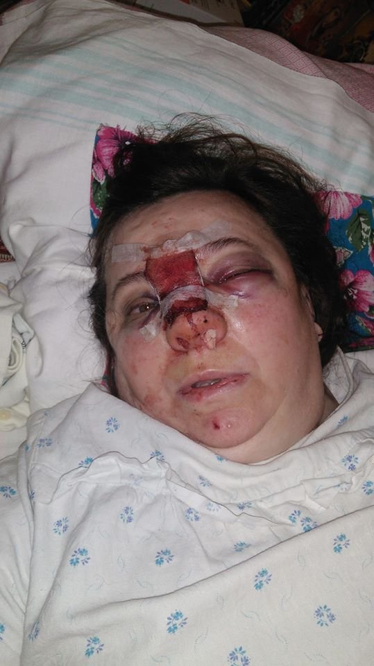 Травмы Екатерины