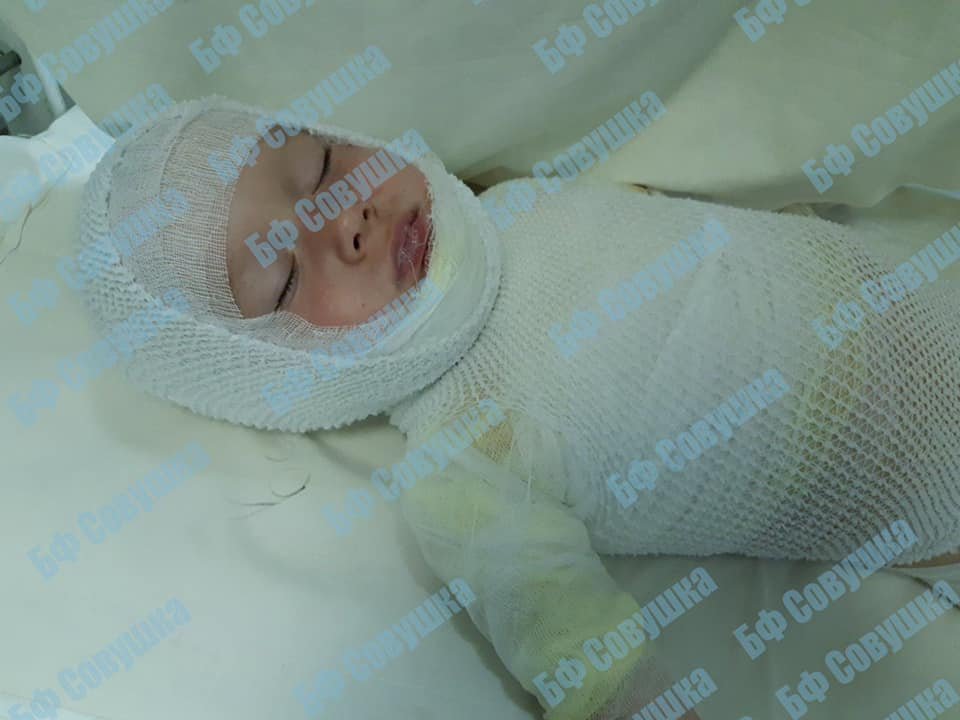 Маленький Рома потянул за полотенце и перевернул литровую кружку кипятка