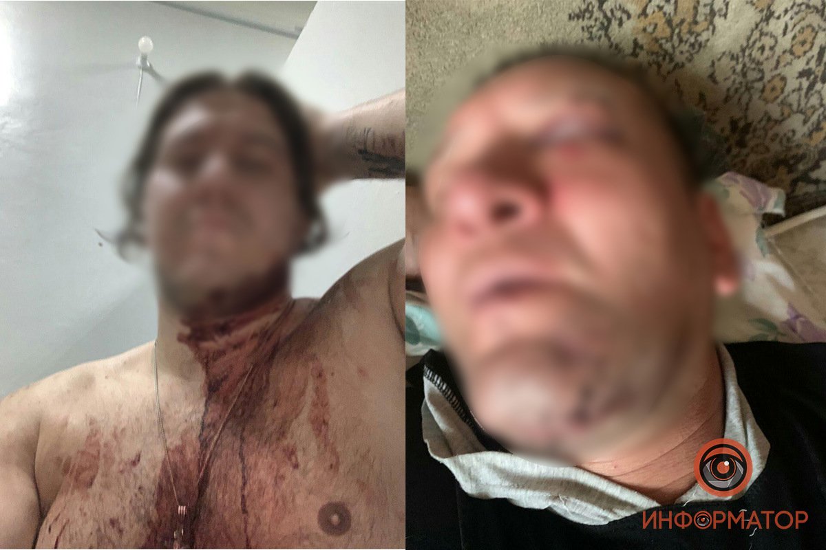 Обоих пострадавших с травмой головы и многочисленными порезами забрала скорая Обоих пострадавших с травмой головы и многочисленными порезами забрала скорая