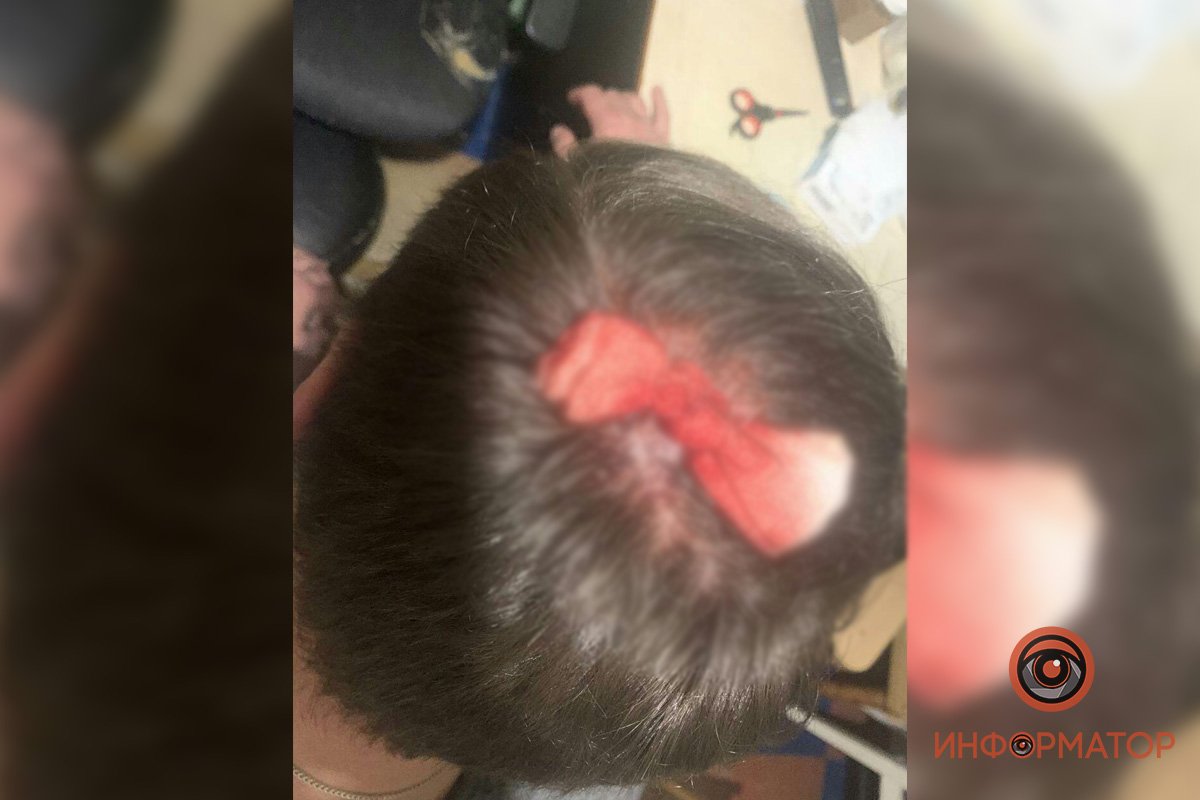 Нападавшие разбили бутылки из-под алкоголя и набросились на мужчин Нападавшие разбили бутылки из-под алкоголя и набросились на мужчин