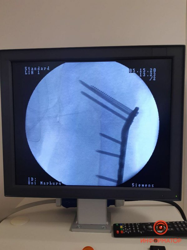 Его прооперировали по современной методике