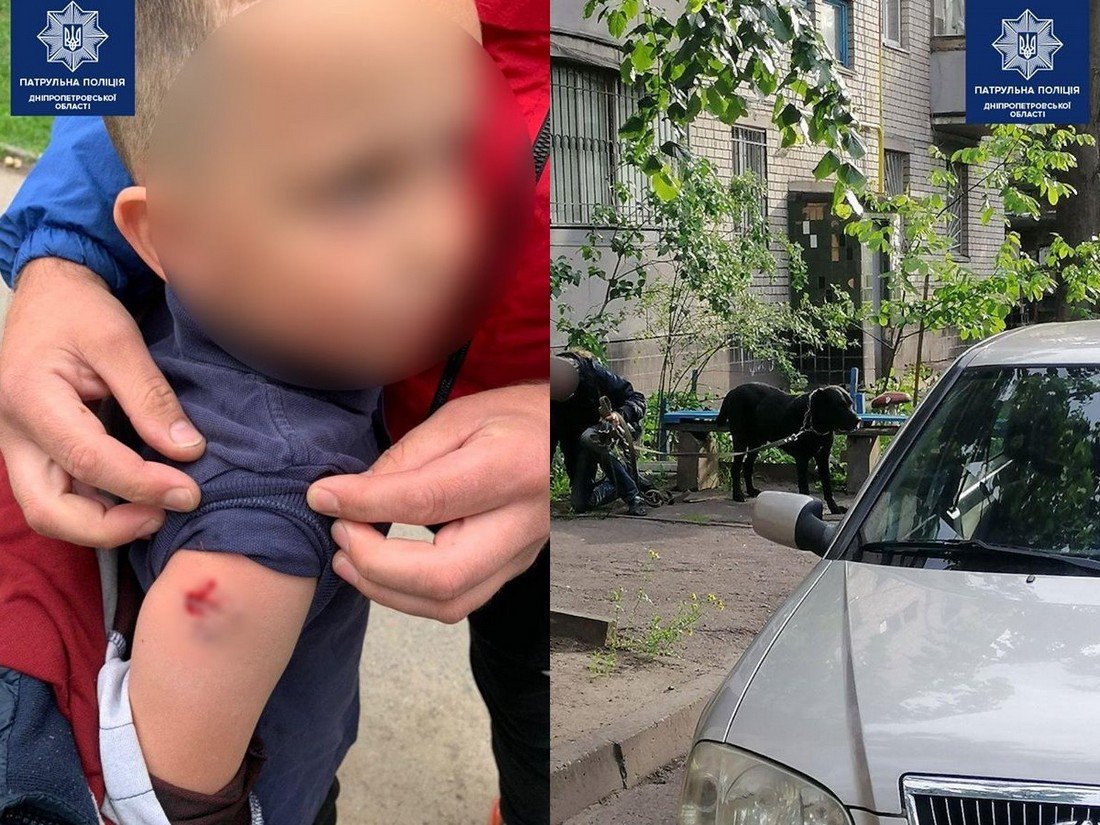 Собака набросилась на 7-летнего мальчика и укусила его за руку Собака набросилась на 7-летнего мальчика и укусила его за руку