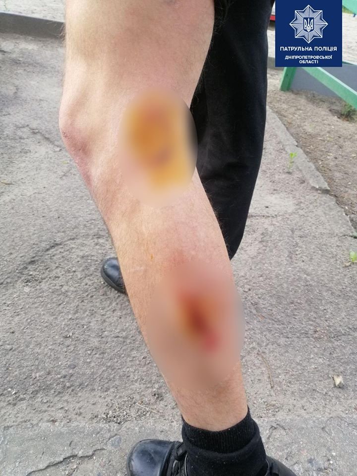 Другой пес вцепился в ногу мужчине на улице Запасной Другой пес вцепился в ногу мужчине на улице Запасной