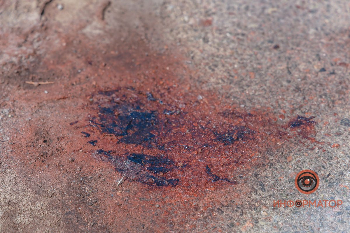 Мужчину госпитализировали Мужчину госпитализировали