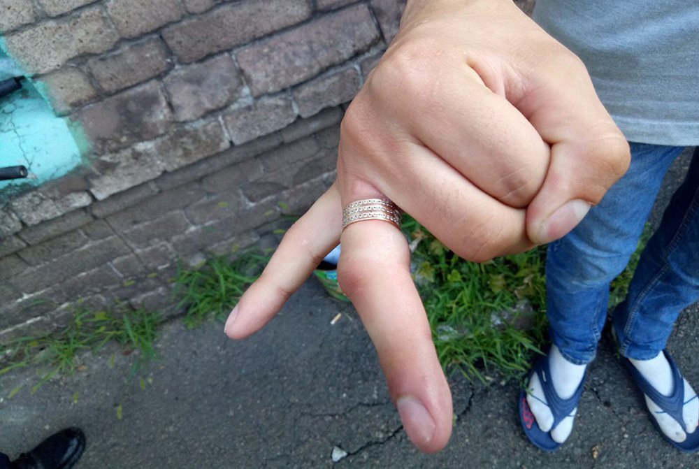 Выход был один: резать Выход был один: резать