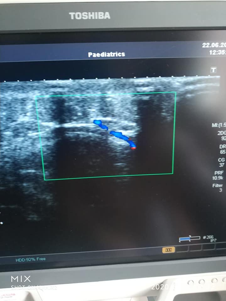 В Днепре 11-летнему мальчику провели сложнейшую 7-часовую операцию 1