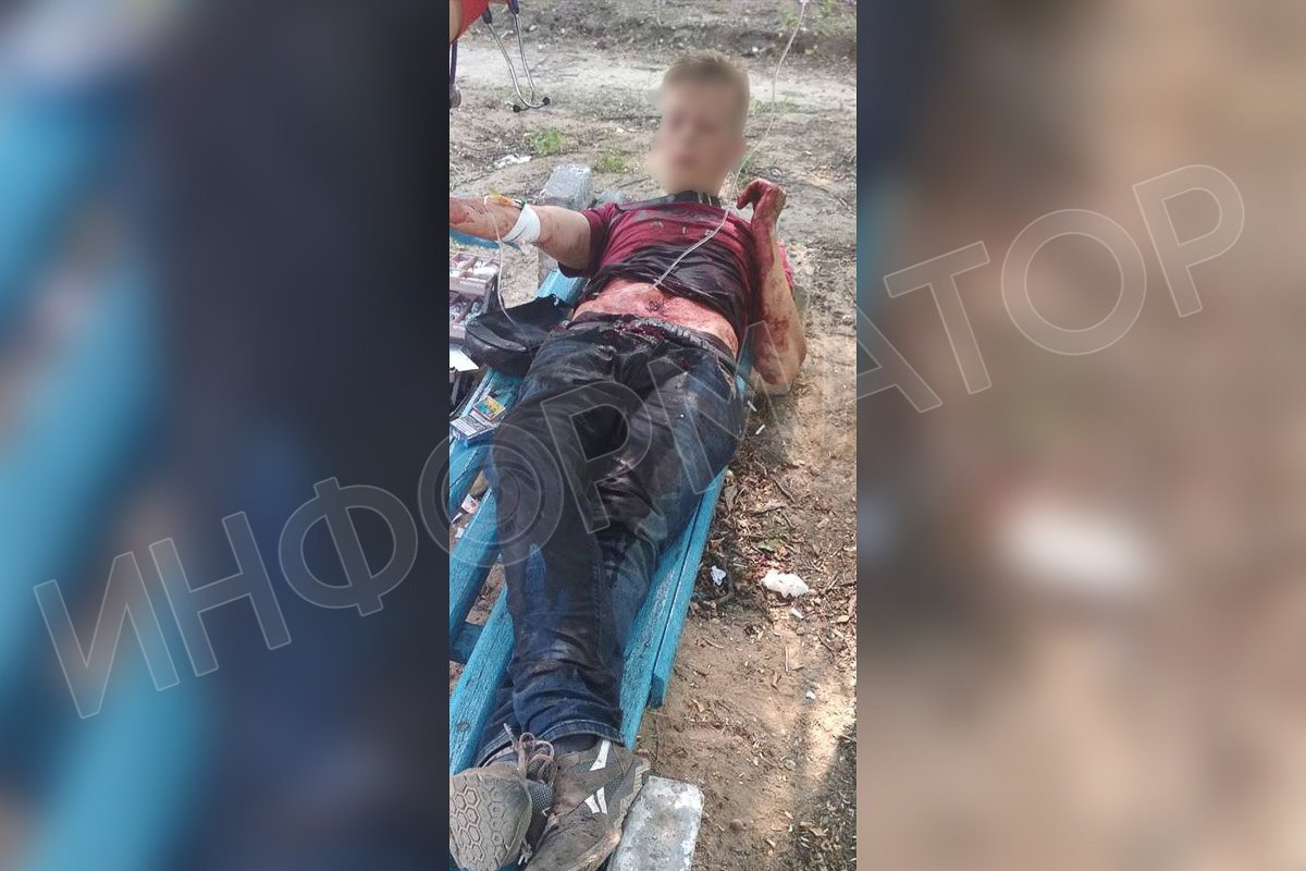 В Днепре 27-летний мужчина вспорол себе живот разбитой бутылкой 4