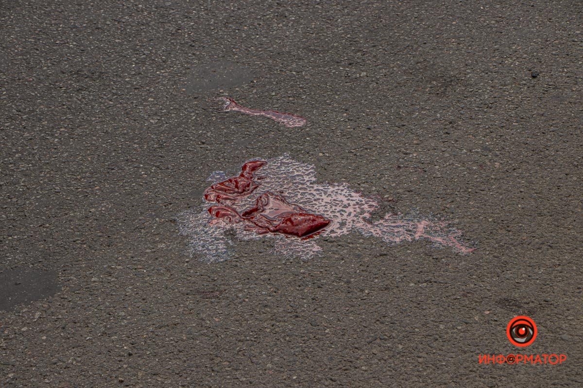 Мужчины получил серьезные травмы