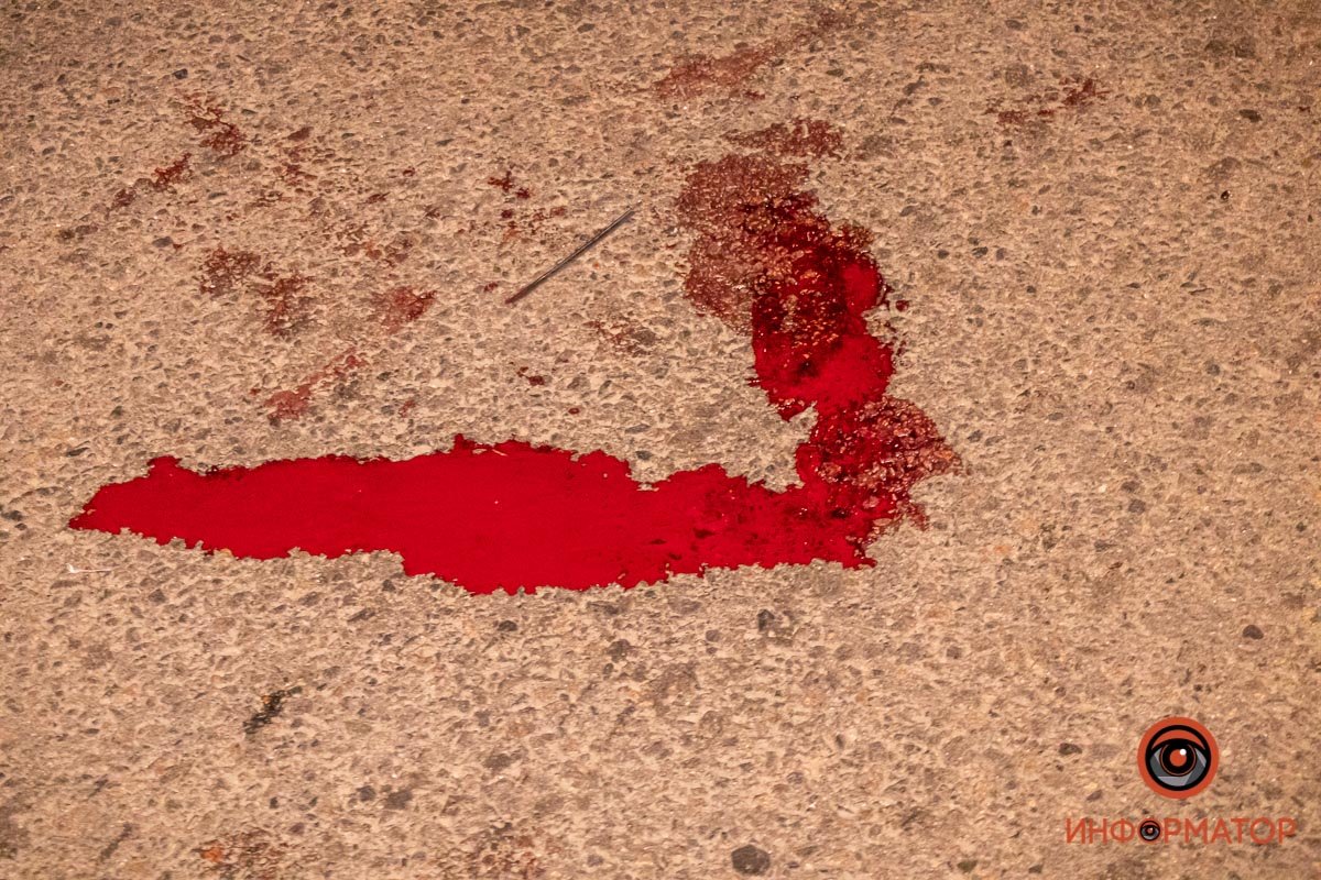 Предварительно, у него случилось кровоизлияние в мозг Предварительно, у него случилось кровоизлияние в мозг