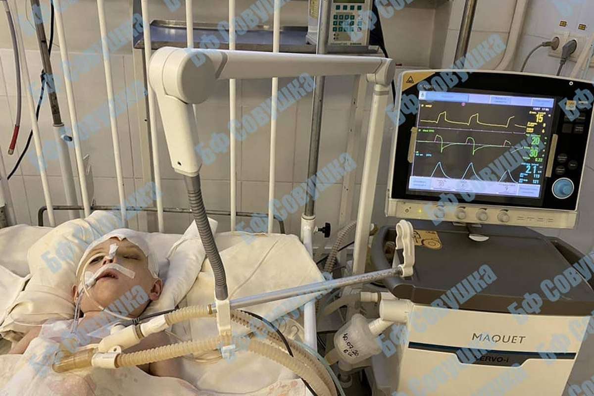 Девочка, которая выпала из окна на Тополе в Днепре, все еще в реанимации: как она себя чувствует 1