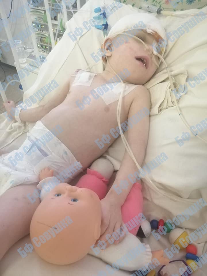 Девочка, которая выпала из окна на Тополе в Днепре, вышла из комы 1