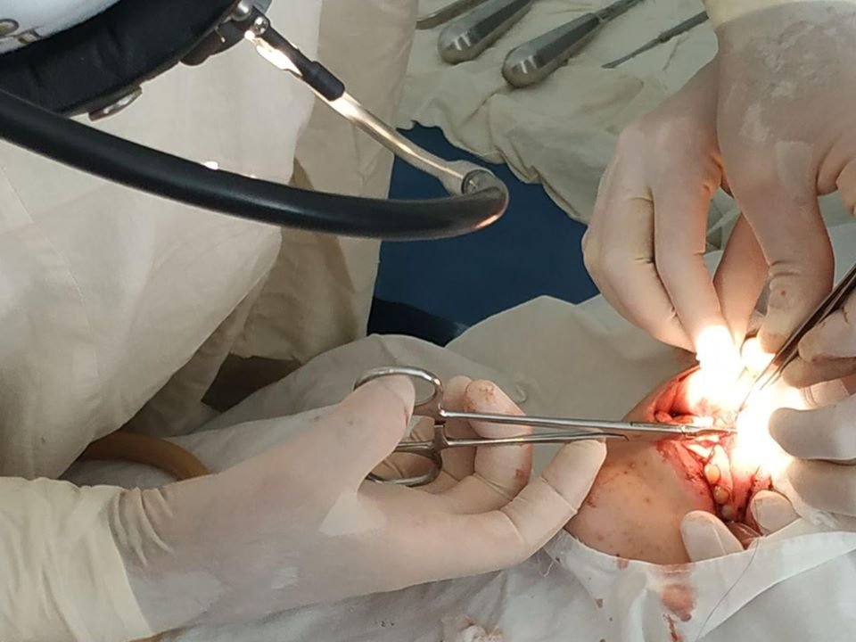 В Днепре на 13-летнего мальчика упала лестница: у ребенка сломан нос и рваные раны на лице 1