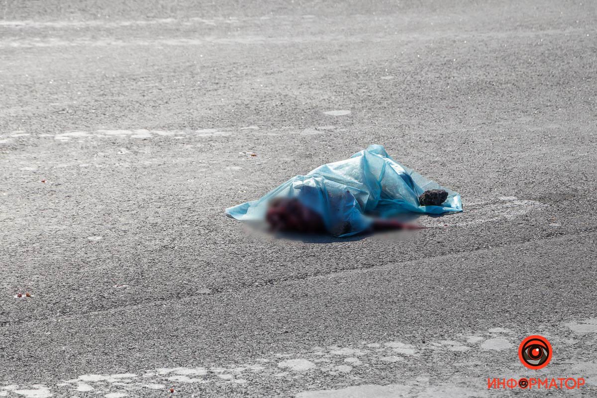 Пешеходу оторвало ногу