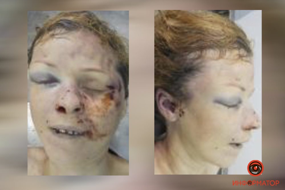 На вид женщине около 30-35 лет